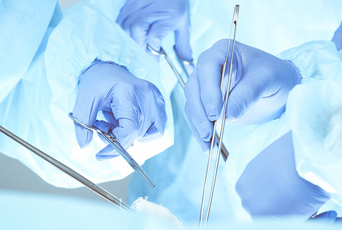 可重复进入，扩大切除范围